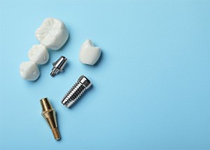 Different dental implant parts come with different costs