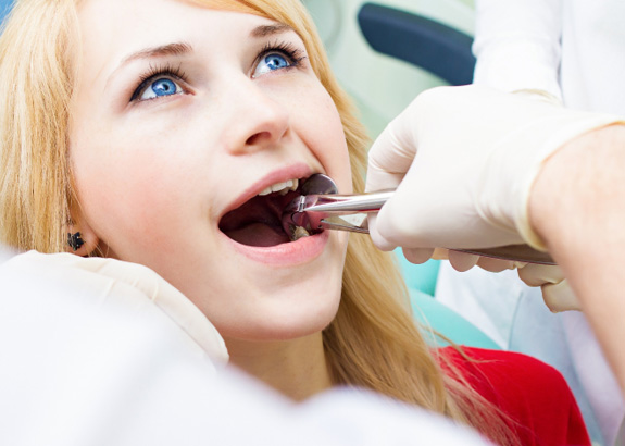 A woman getting a wisdom tooth extracted