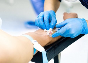 Dentist administering IV sedation into the crook of a patient’s elbow