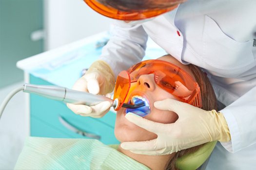 Dentist applying UV light to harden dental filling