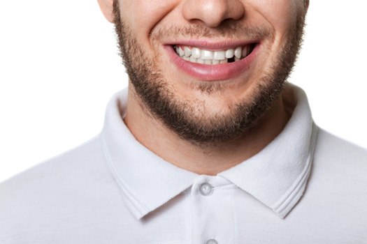 We repair broken teeth near Somerville