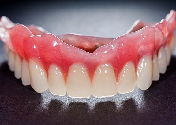 Full upper denture