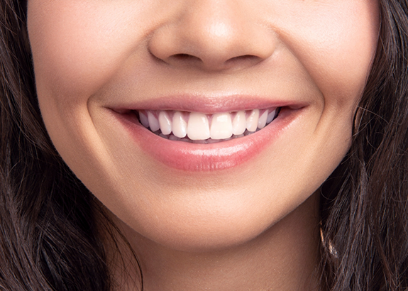 Close up of a woman smiling with flawless teeth