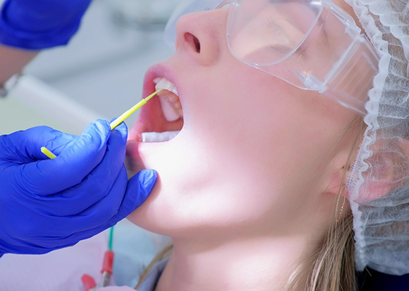Dental patient having fluoride applied to their teeth