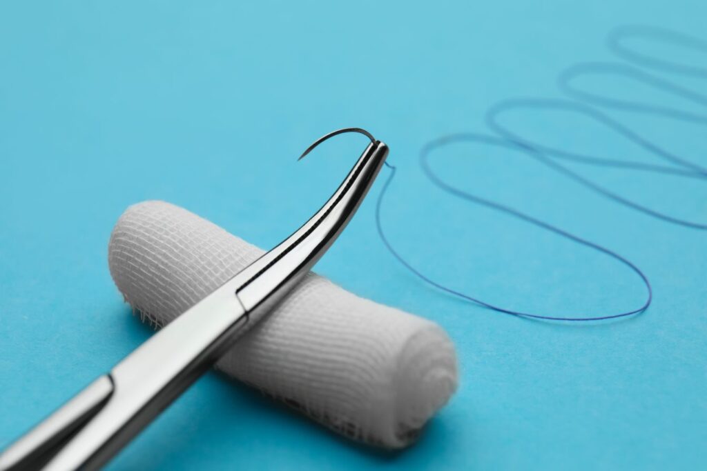 Dissolving stitches